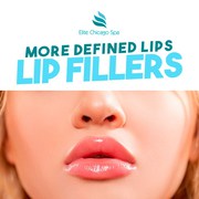 Lip Fillers Chicago | Lip Fillers Chicago Injections - Elite Spa